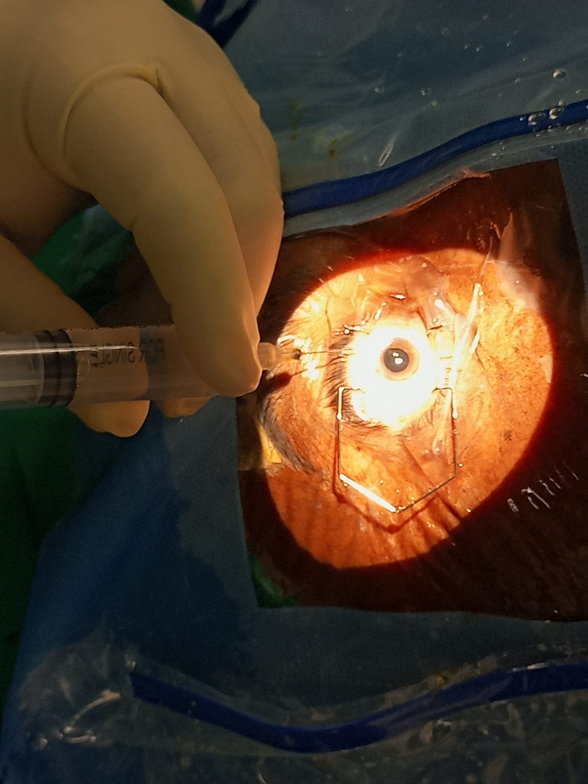 Eye Surgery